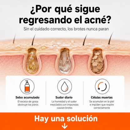 Quarxery Gel Anti Acné Corporal | Piel Limpia y Sin Granitos Desde la Primera Semana