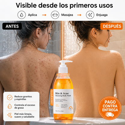 Quarxery Gel Anti Acné Corporal | Piel Limpia y Sin Granitos Desde la Primera Semana