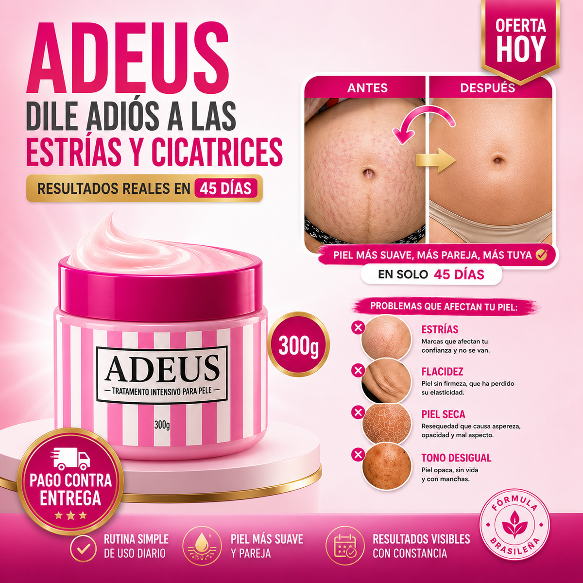 ADEUS | Adiós a las Estrías y Cicatrices