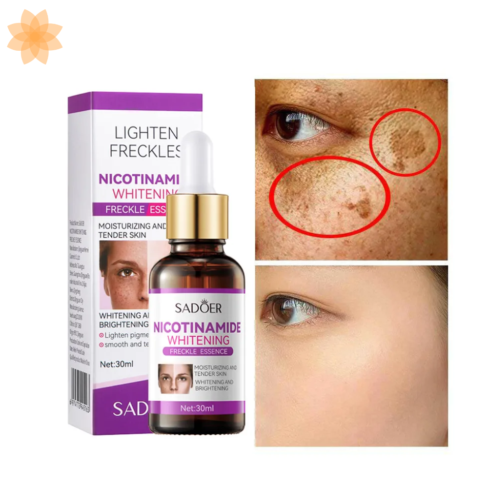 Serum Blanqueador Aclarante Quita Manchas 💋