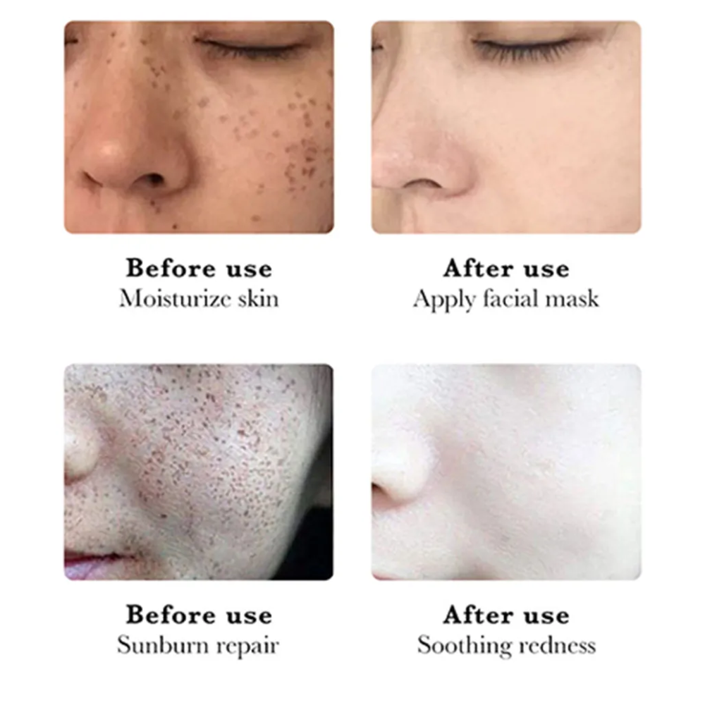 Serum Blanqueador Aclarante Quita Manchas 💋