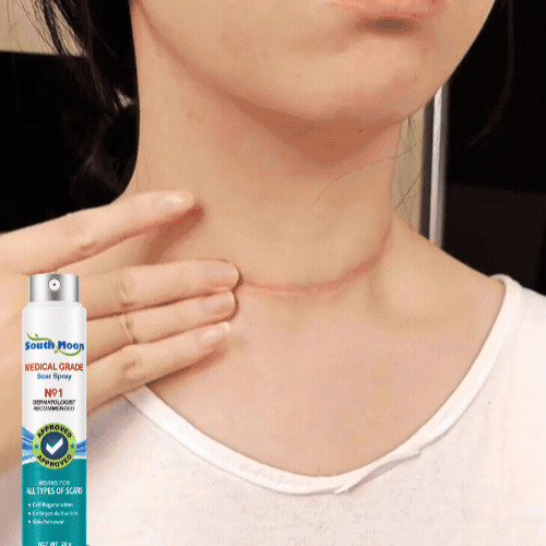 South Moon Scar Spray | Cicatrices Menos Visibles en Semanas